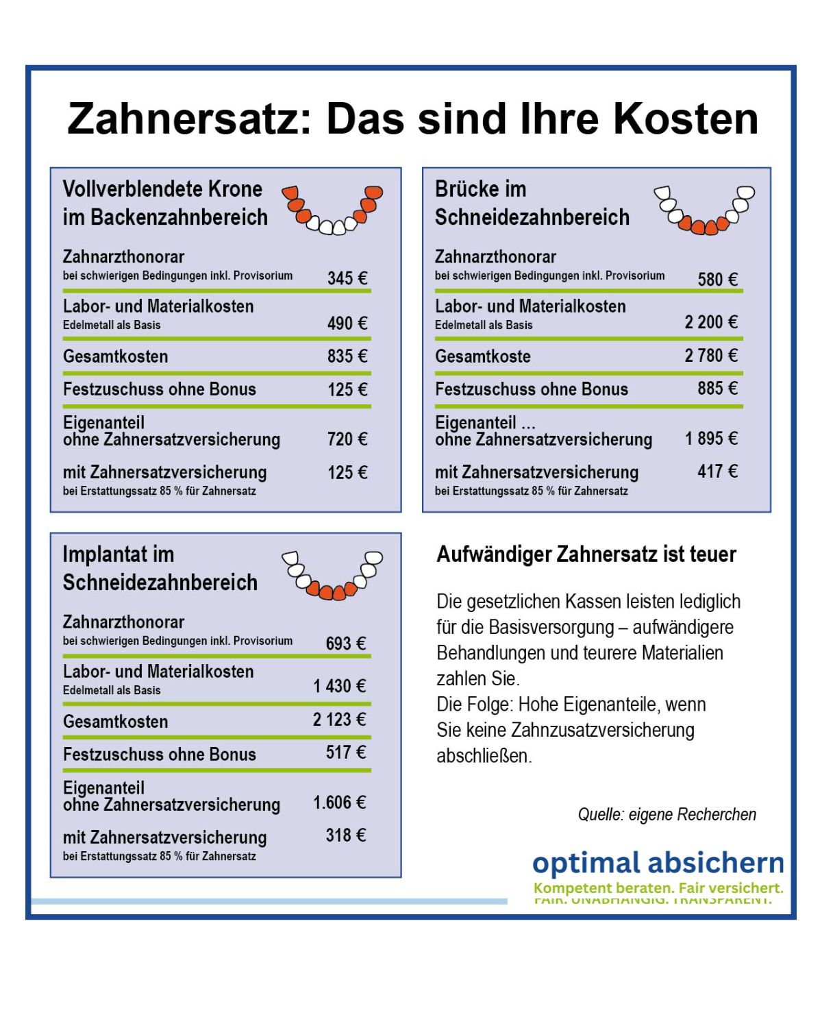 Die Grafik zeigt, wie teuer Zahnersatz ohne Zahnzusatzversicherung ist